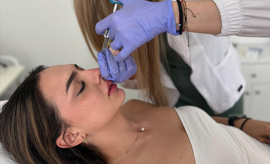 Armonización facial con ácido hialurónico en Madrid